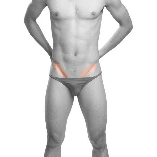 Man with the bikini line highlighted for laser hair removal